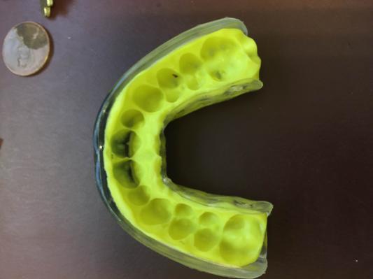 Photo submitted with review of product