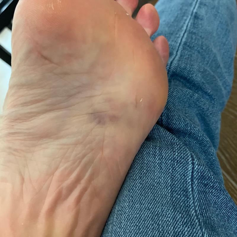 Photo submitted with review of product