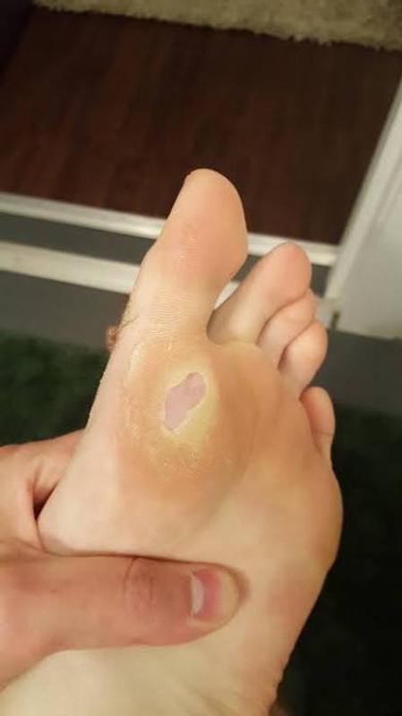 Photo submitted with review of product