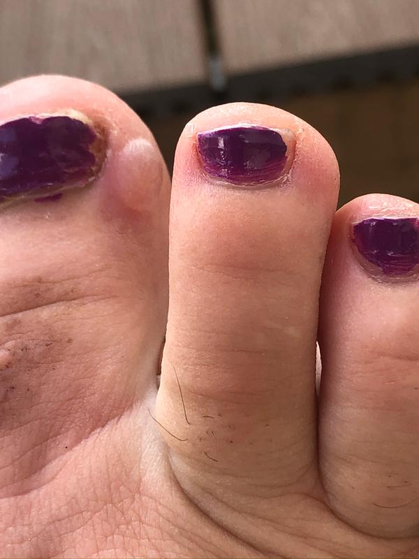 Photo submitted with review of product