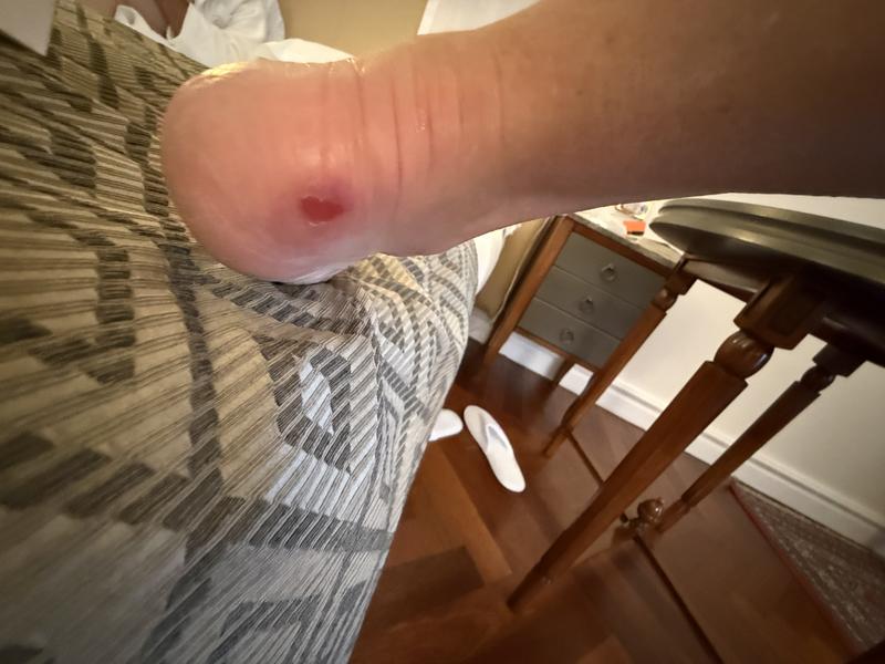 Customer photo for "Poor quality"