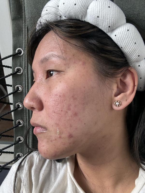 Skin Recovery Foaming Cleanser with Amino Acids | EltaMD®