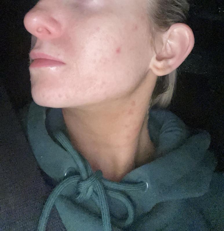 Review Thumbnail Image 1 1176704261