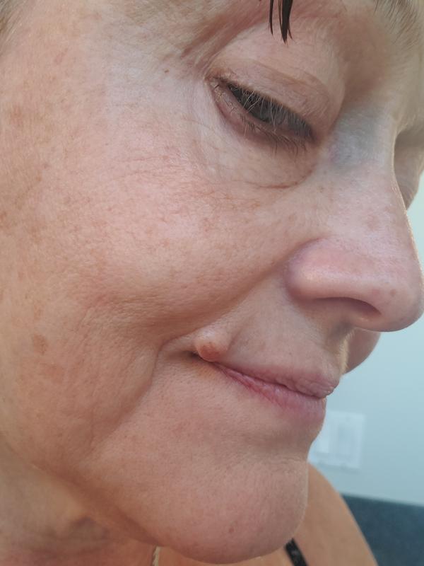 My skin still looks dry and 'tacky' after applying this cream (on top of the serum and after using Elemis gentle rose exfoliant)