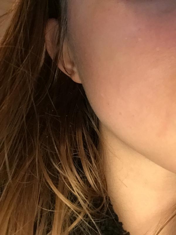 Irritation from fragrance