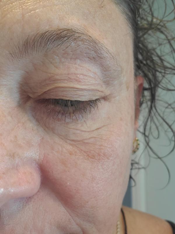 Those creases/wrinkles appeared after applying the eye cream with the special ball applicator.