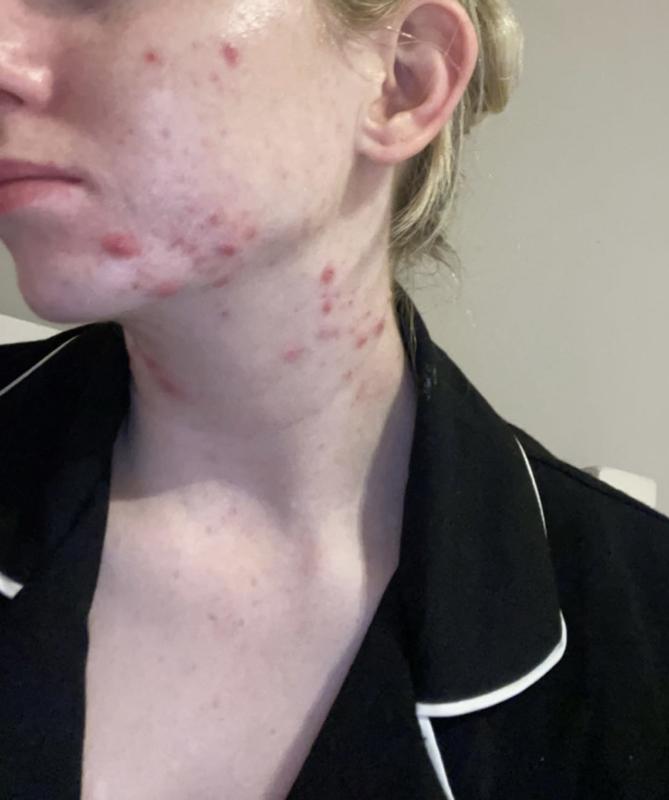 Review Thumbnail Image 0 1176704261