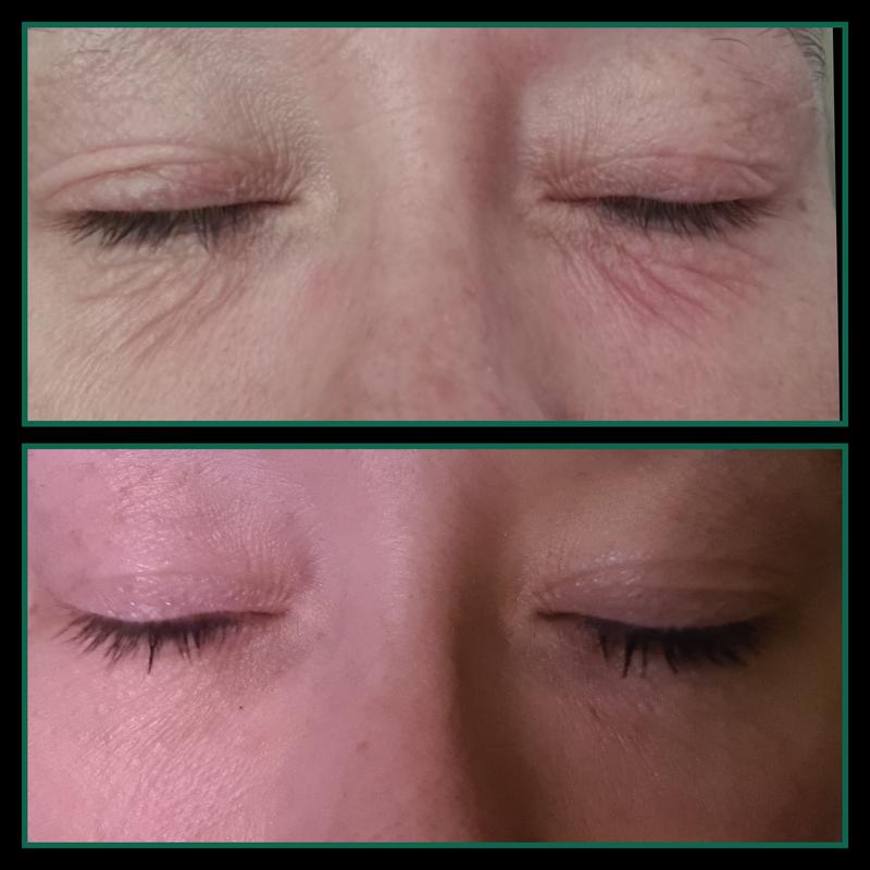 I can confirm The photos above are of me 7 days apart. Fab product!!!!