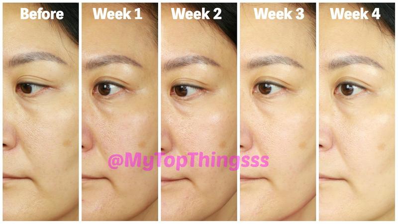 YouTube MyTopThingsss