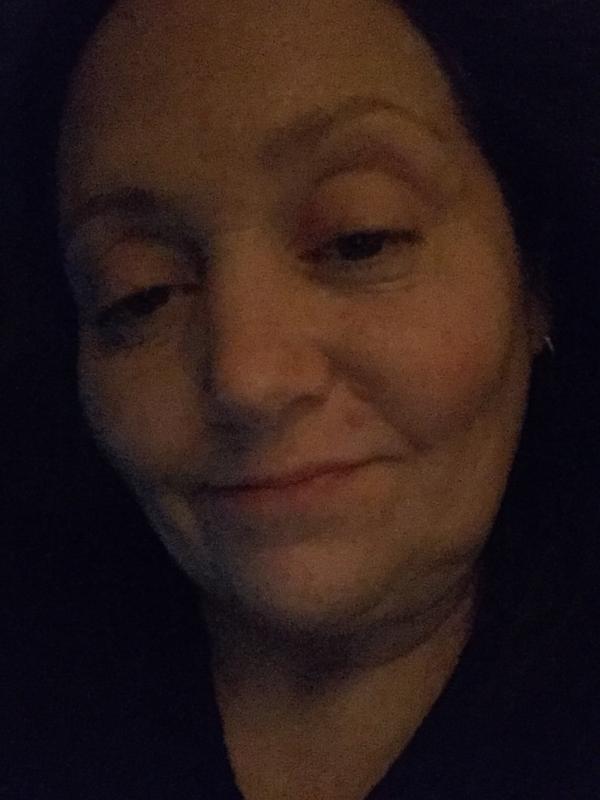 Removed some of the small red bumps I have below my lip and under my eye
