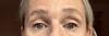 Far wider, brighter, firmer eyes a week after using vitamin C eye cream