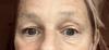Before using vitamin C eye cream