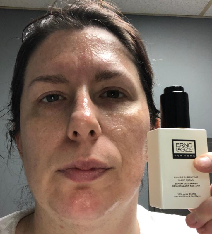 Customer photo for "AHA resurfacing sleep serum"
