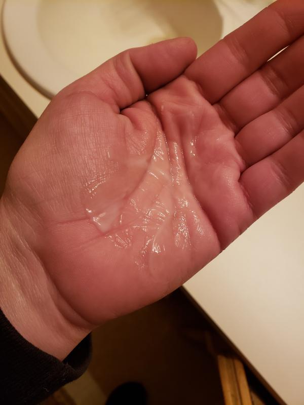 Customer photo for "'The Holy Grail' of Skincare Serums!!"
