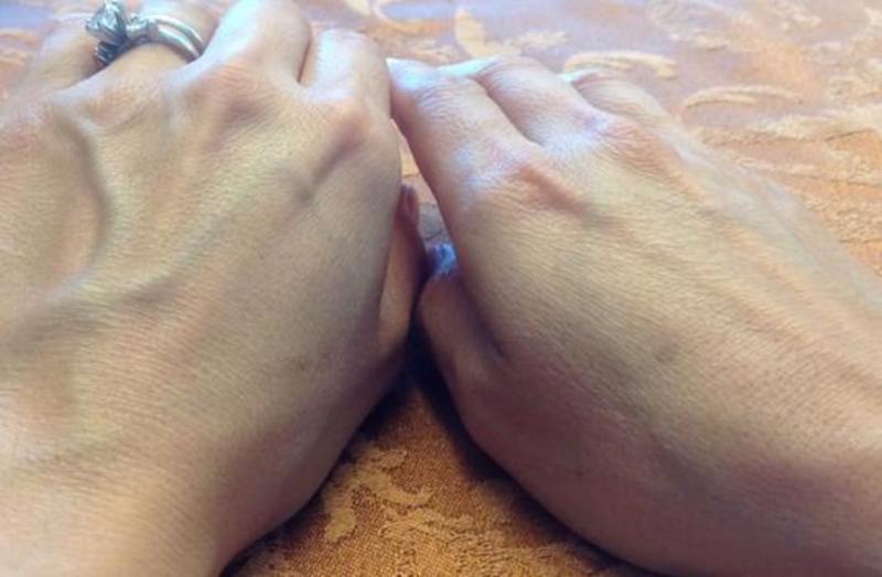 left vs right hand wrinkle imrpovement
