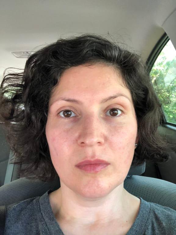 Freshly washed and moisturized face.