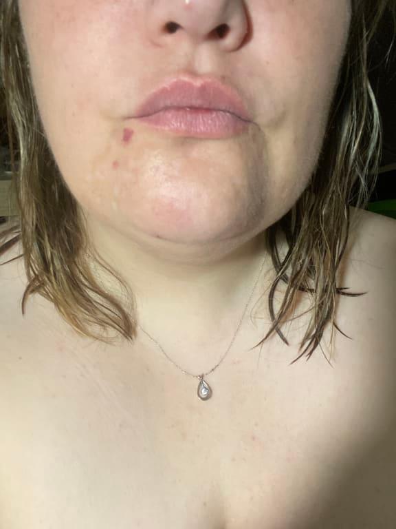 The white marks use to be 10x worse