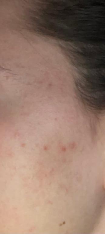 After (no makeup)