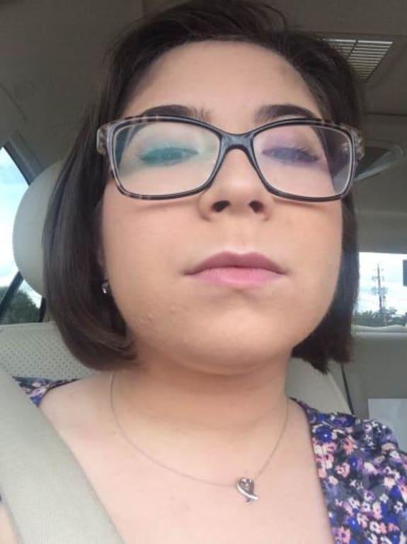 My face and my chest do not match and it's ridiculous.