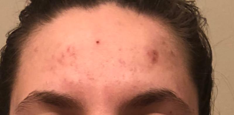 Before (no makeup)