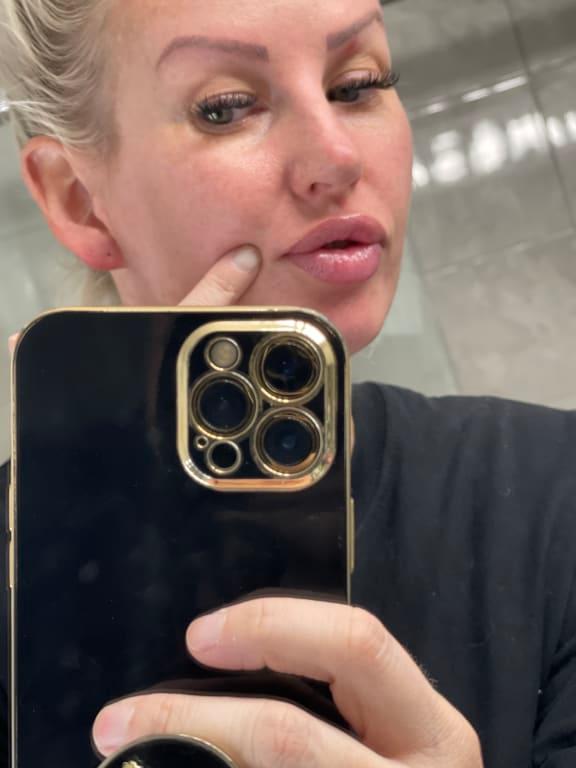 Naked face before bed and lips on point!