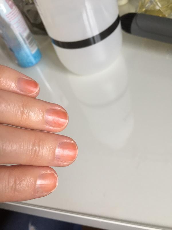 After 3 tries with remover and acetone