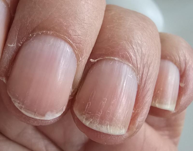 after 10 days of use
