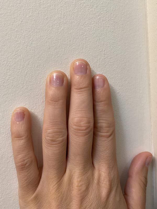 Seriously helps nail flaking