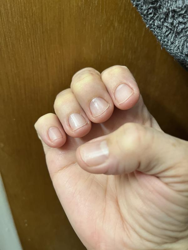 No gloss on either index finger and very chipped on other fingers
