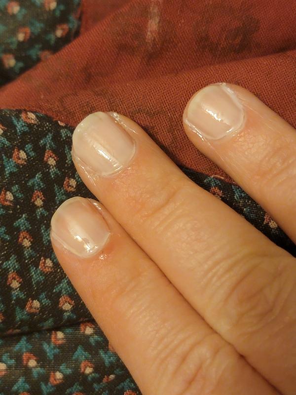 Finger print in nail