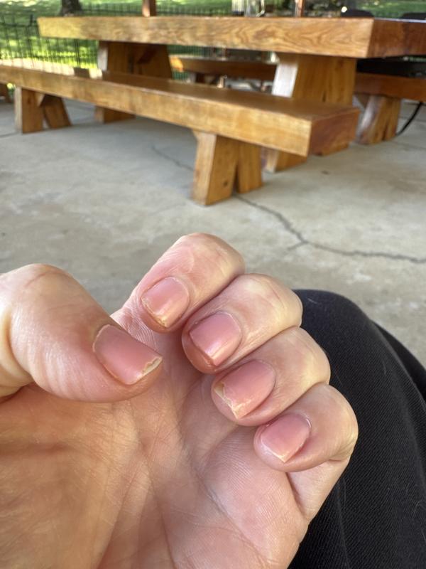 Chipped the next day