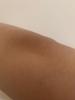 Elbow