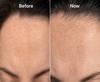 Before and now - no visible results