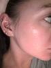 After skin