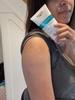 Body acne