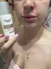 Skin problems still not resolved