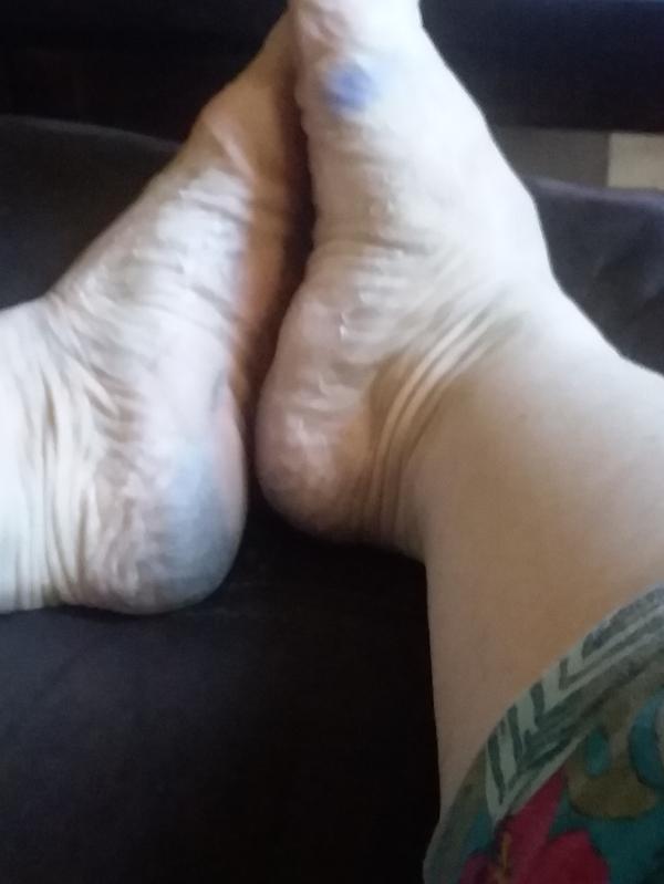 Second day after wear