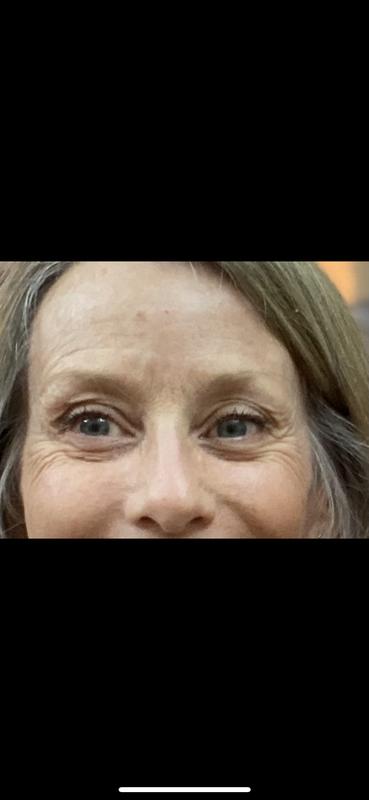 Before using Bear mini