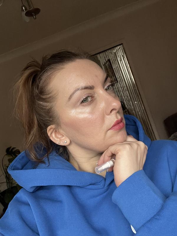 I have acne skin,and look how beautiful is no,I love it ❤️❤️❤️