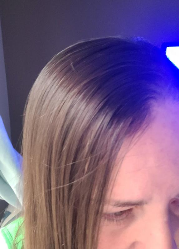 (Before) Thin, fine hair.