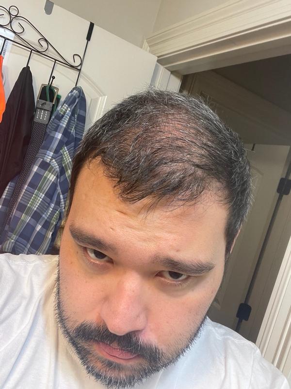 Review Thumbnail Image 0 377353382