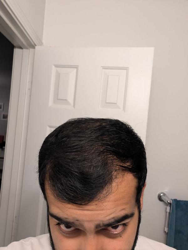 Review Thumbnail Image 2 376572432