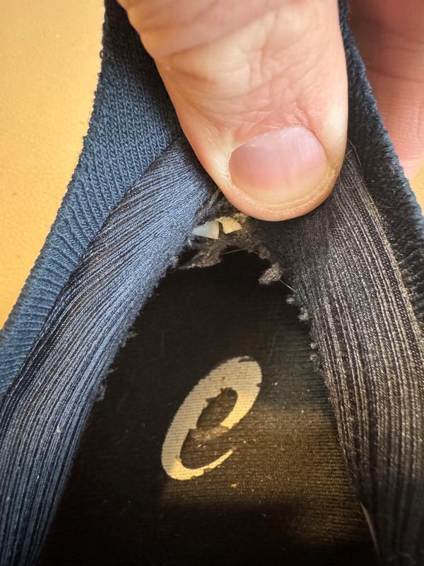 Knife edges cut both heals after 4 months