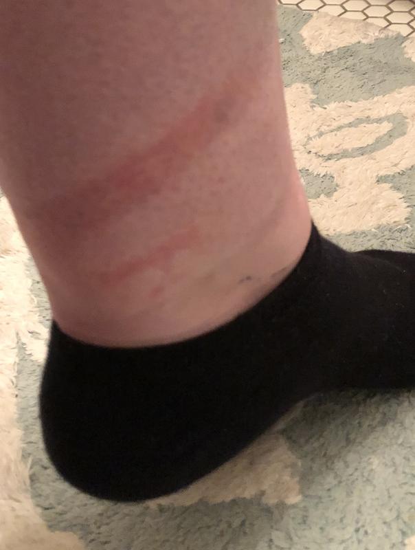 rubbing from the boot cuff after less than a day wearing them