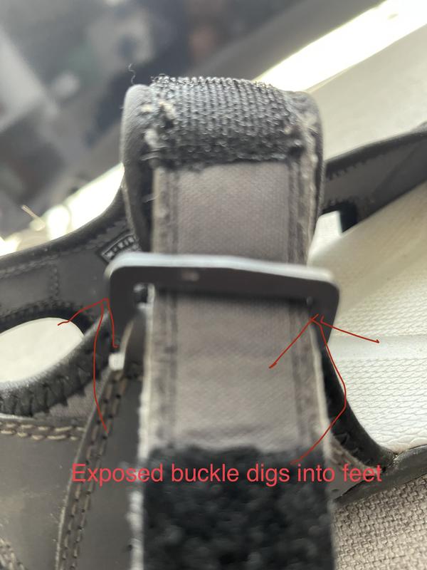 Exposed buckles dig into feet and creates wound