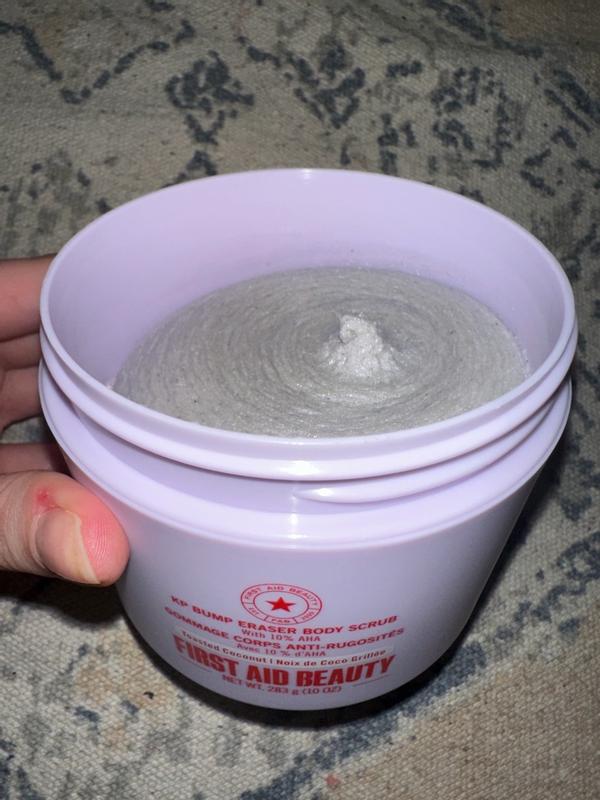 Customer photo for "Great for those annoying bumps!"