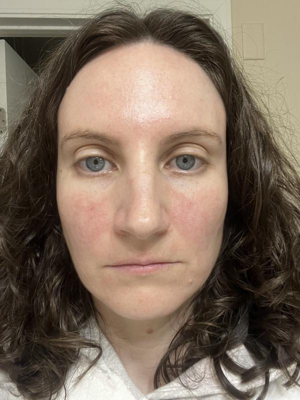 Review Thumbnail Image 0 380082814