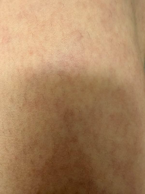 Review Thumbnail Image 2 383410403