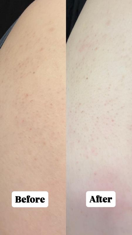 Review Thumbnail Image 0 384920418