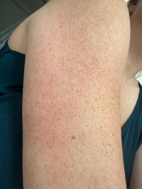 Review Thumbnail Image 0 382805316